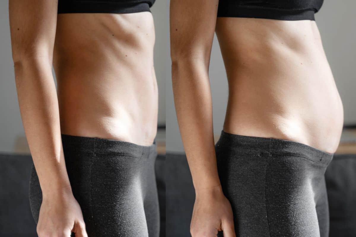 How long does diastasis recti take to improve Wiltshire?