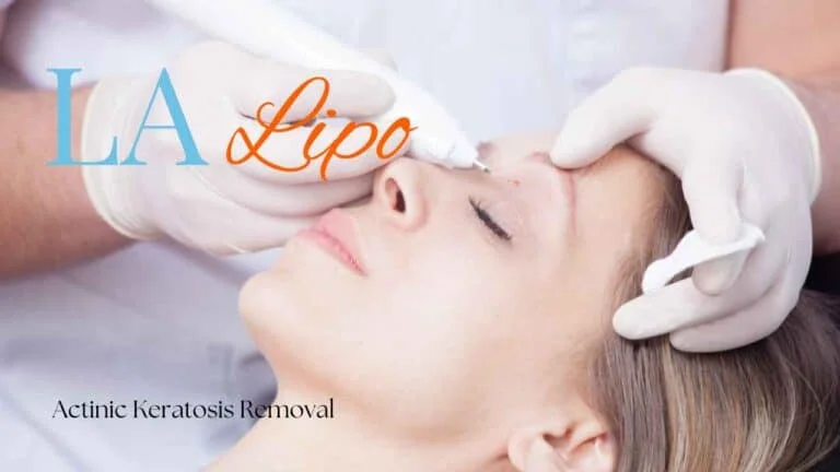 Woman receiving Actinic Keratosis Removal Treatment Wiltshire