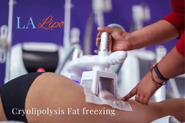 women getting fat freezing Wiltshire