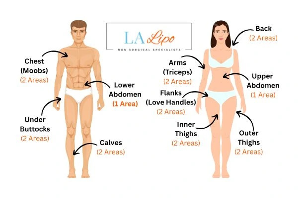 LA LIPO Cryolipolysis Areas Wiltshire