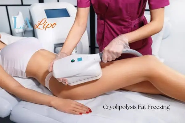 Woman receiving coolsculpting Wiltshire treatment on her thighs