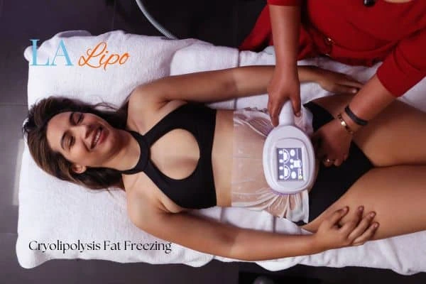woman getting cryolipolysis Wiltshire