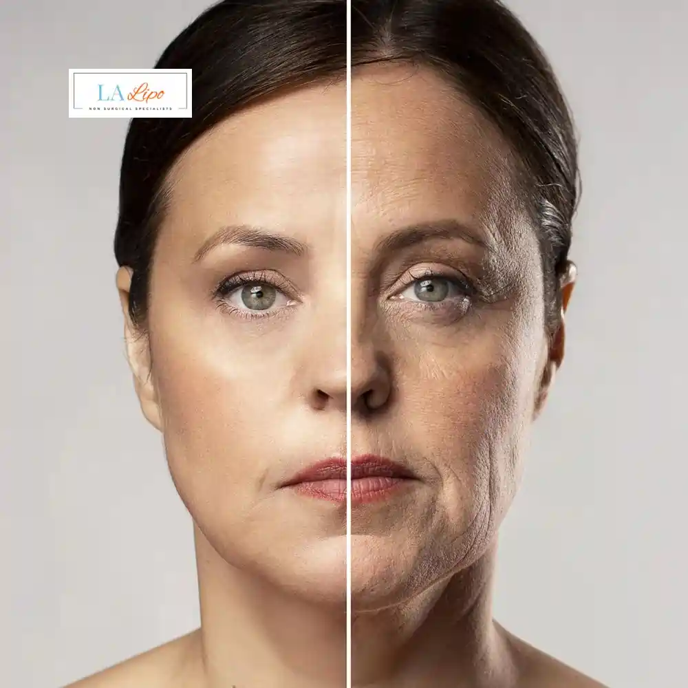 How Can You Tell If Non-Surgical Skin Tightening Is Right for You Wiltshire?