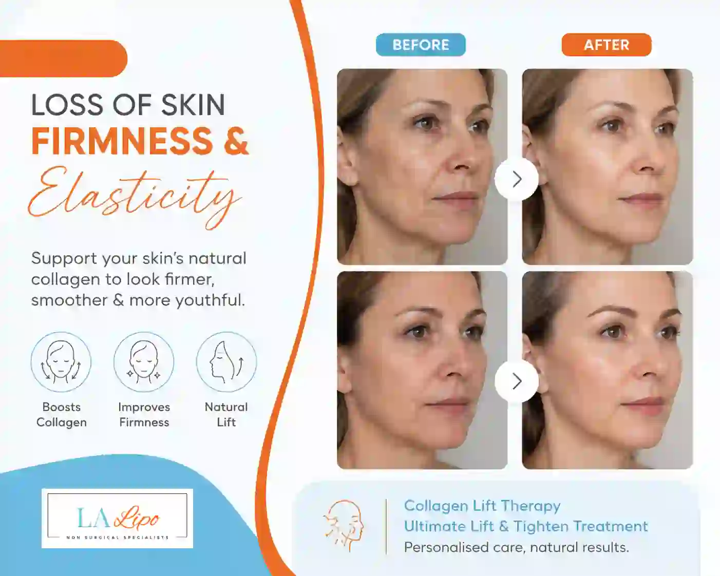 Sign #7: Loss of Skin Firmness and Elasticity Wiltshire