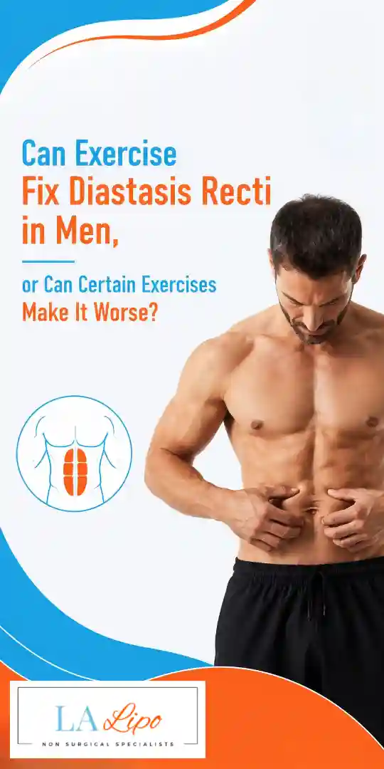 Can Exercise Fix Diastasis Recti in Men, or Can Certain Exercises Make It Worse Wiltshire?